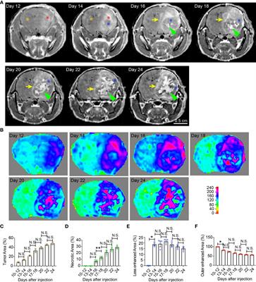 Temporal radiographic and histological study of necrosis development in a mouse glioblastoma model